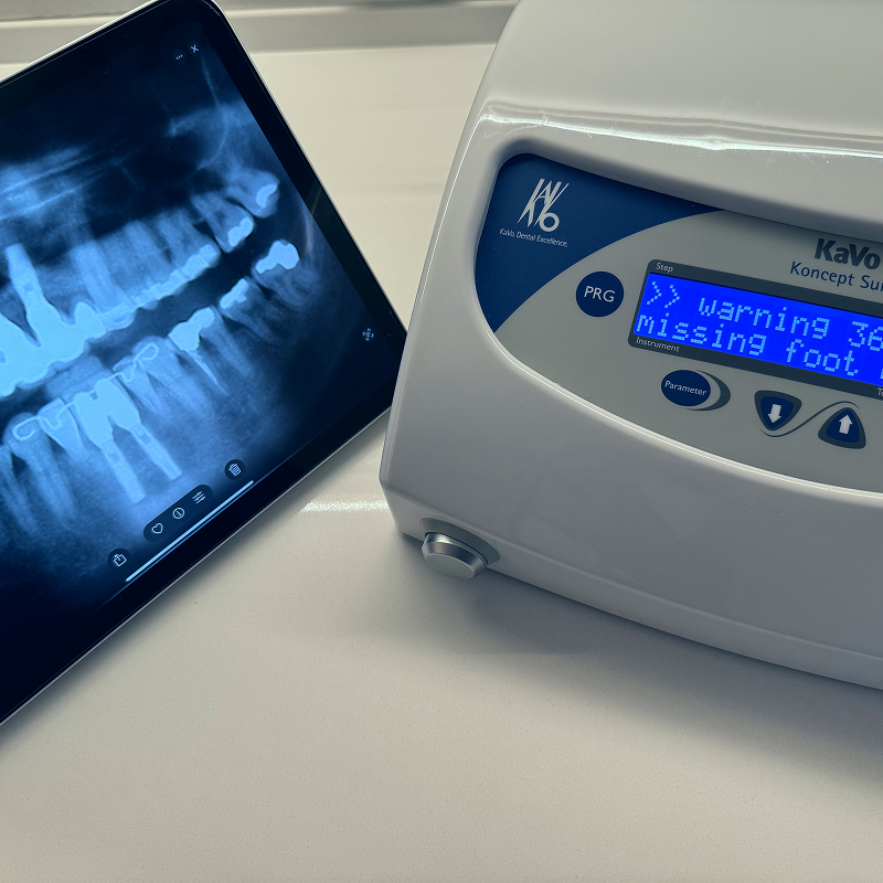 Implantes Dentários