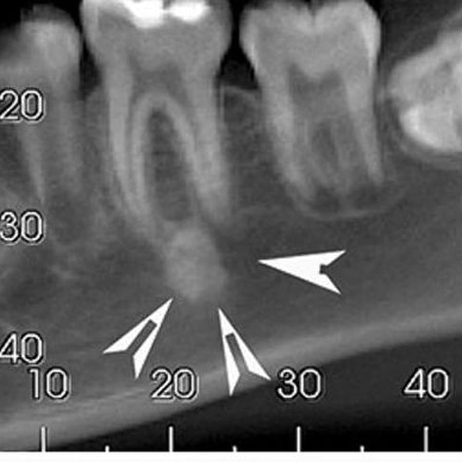 Cirurgia Odontológica