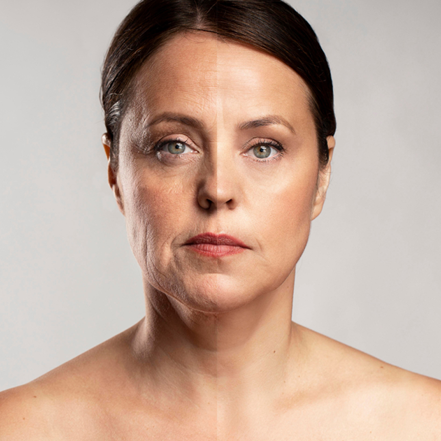 Harmonização Facial