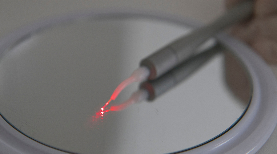 Remoção de Mucoceles