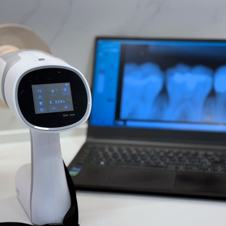 Restauração Dental