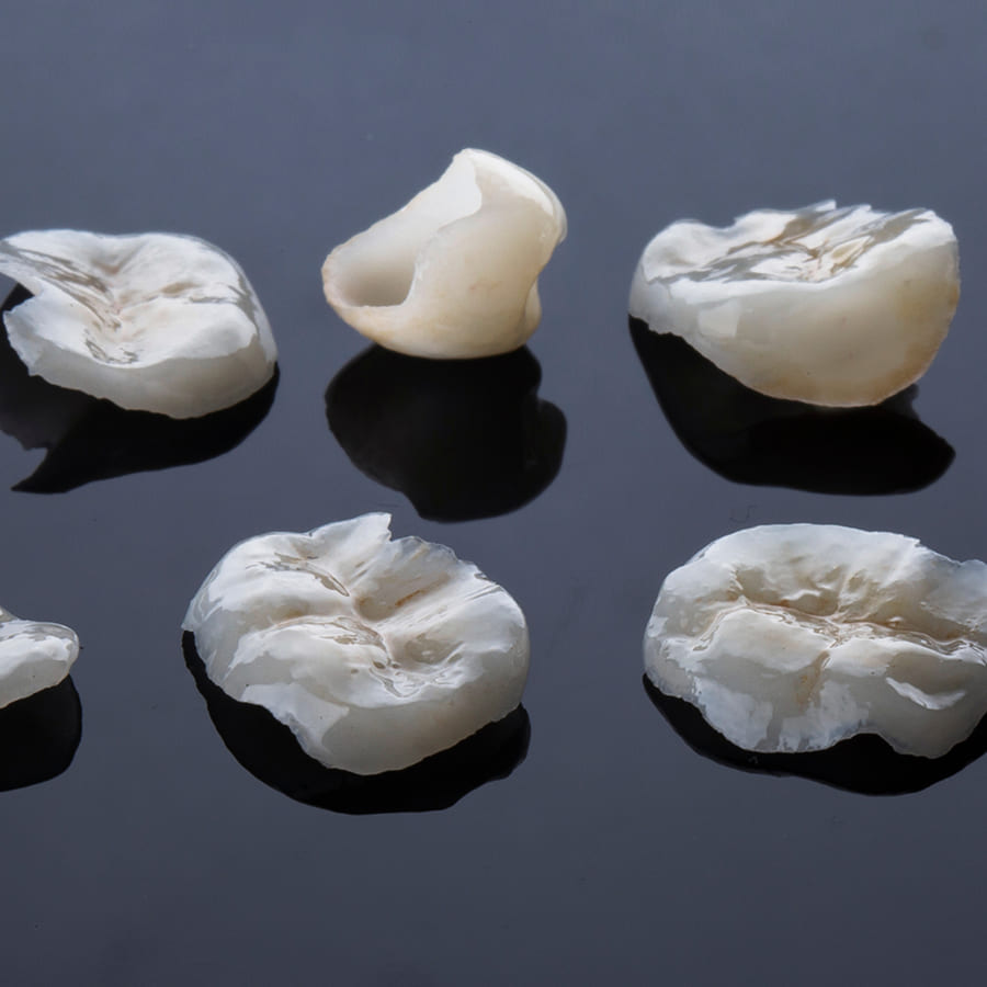 Restauração em Porcelana