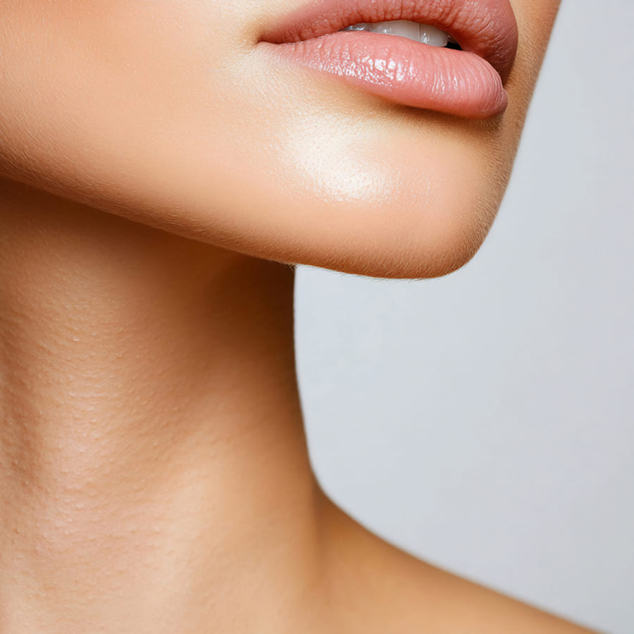 Preenchimento de Queixo