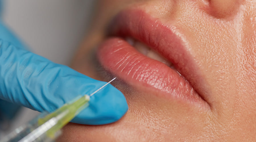 Preenchimento Labial