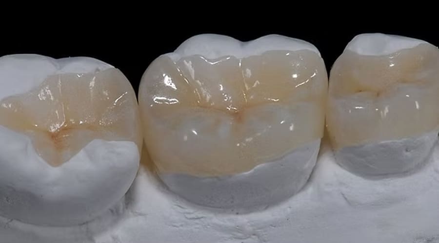 Restauração em Porcelana