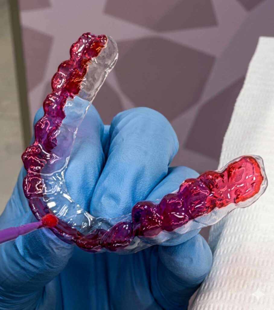 Placa diagnóstica de bruxismo utilizada na avaliação